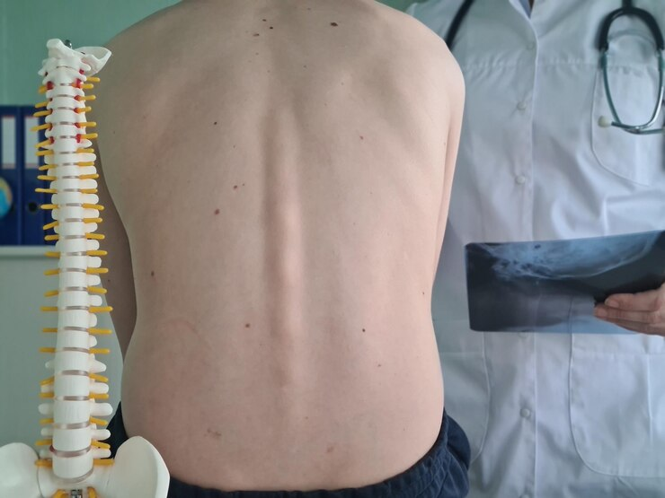 Spine Surgery